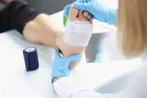 Doctor hand touches and examines diabetic wound on leg