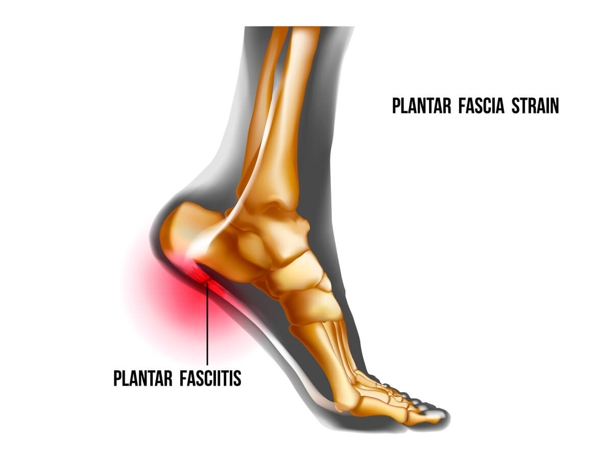 Foot Pain: Causes & Treatment