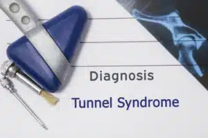 Neurological diagnosis of Tarsal Tunnel syndrome