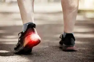 A person running is experiencing heel pain.