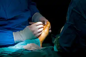 Surgeons are performing foot surgery on a patient to surgically remove a bunion.