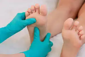 A female doctor's hands in a blue medical gloves holding a girl's foot and examining her for flat feet condition.