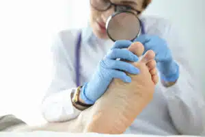 A foot doctor examines a patient's toenail with a magnifying glass for signs of toenail fungus.