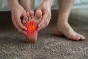 pain in the foot due to Plantar Fasciitis