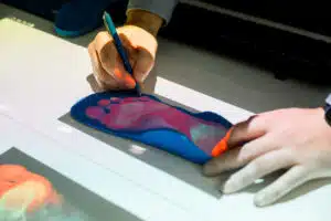 Person marking custom orthotic insole for foot health